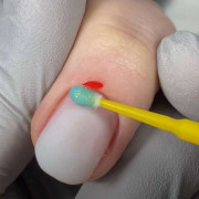 Кровоспинні засоби